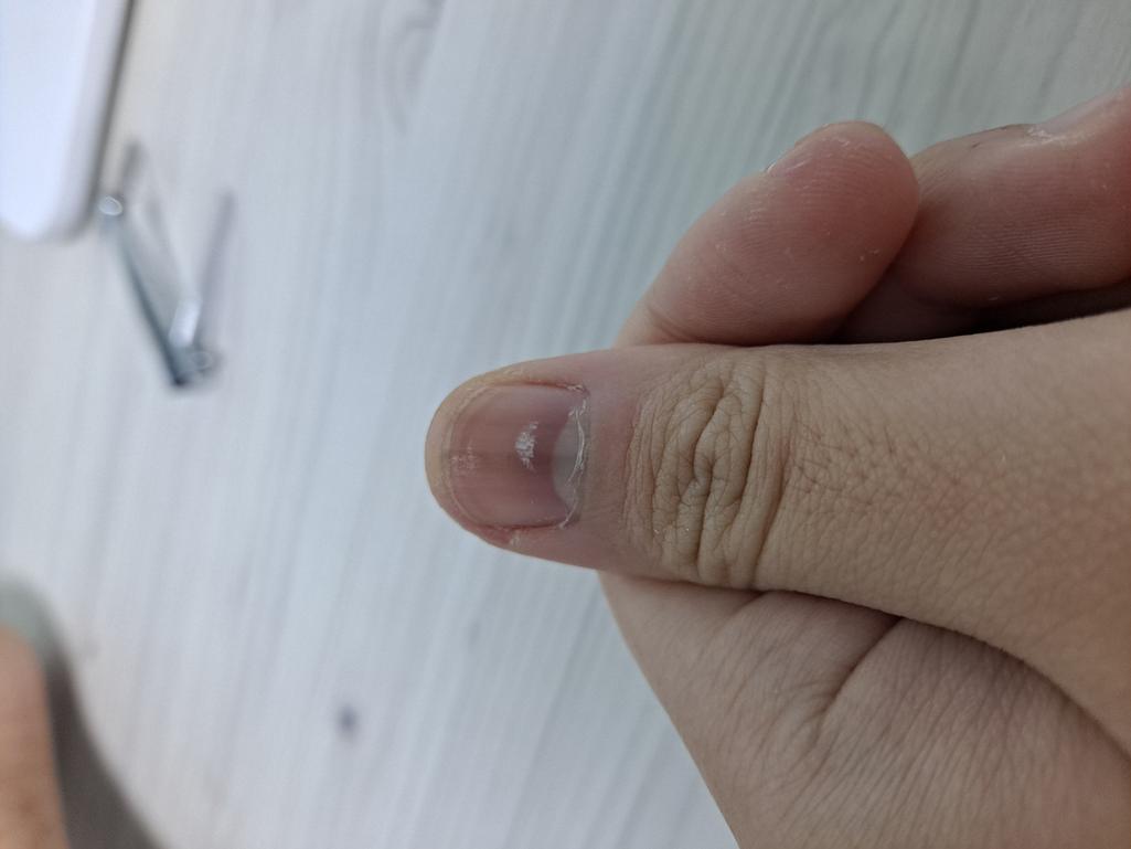 2번 째 사진