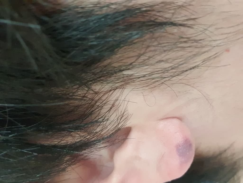 1번 째 사진