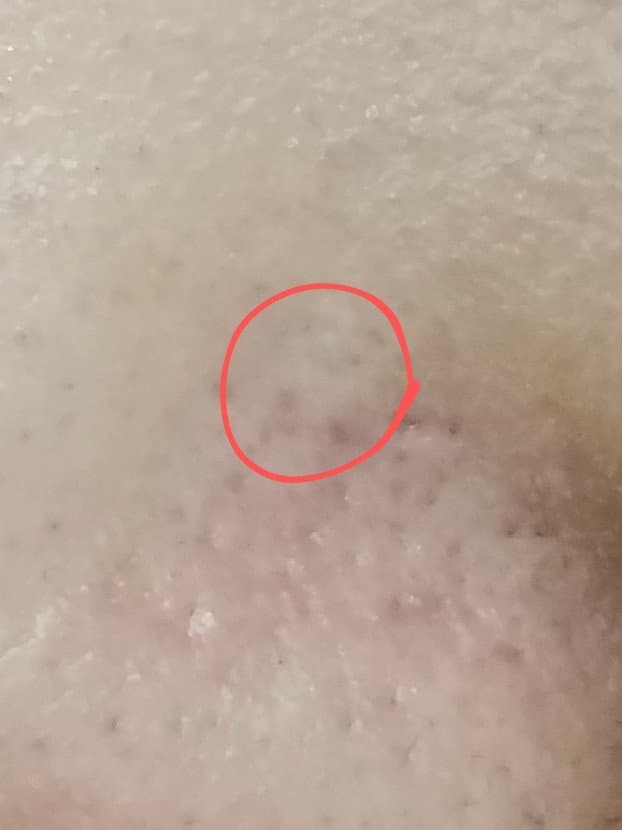 2번 째 사진