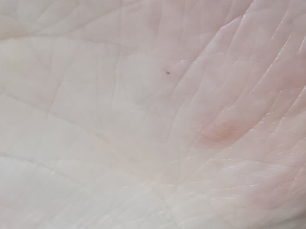 2번 째 사진