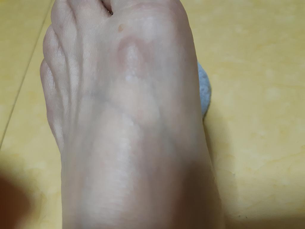 2번 째 사진