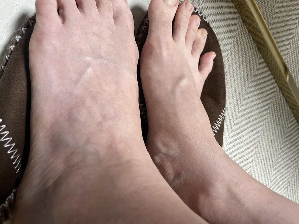 2번 째 사진