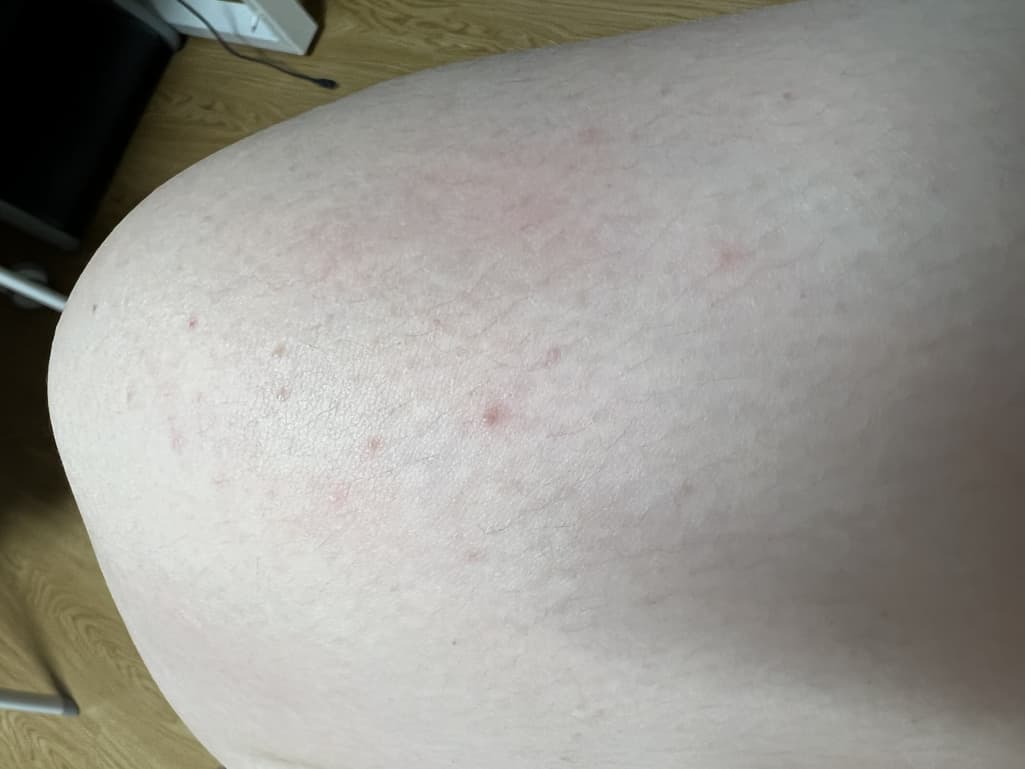 2번 째 사진