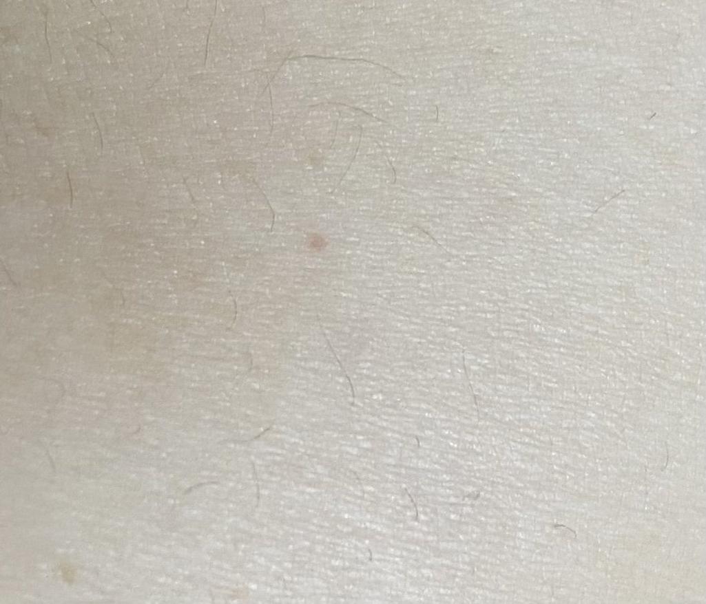 2번 째 사진