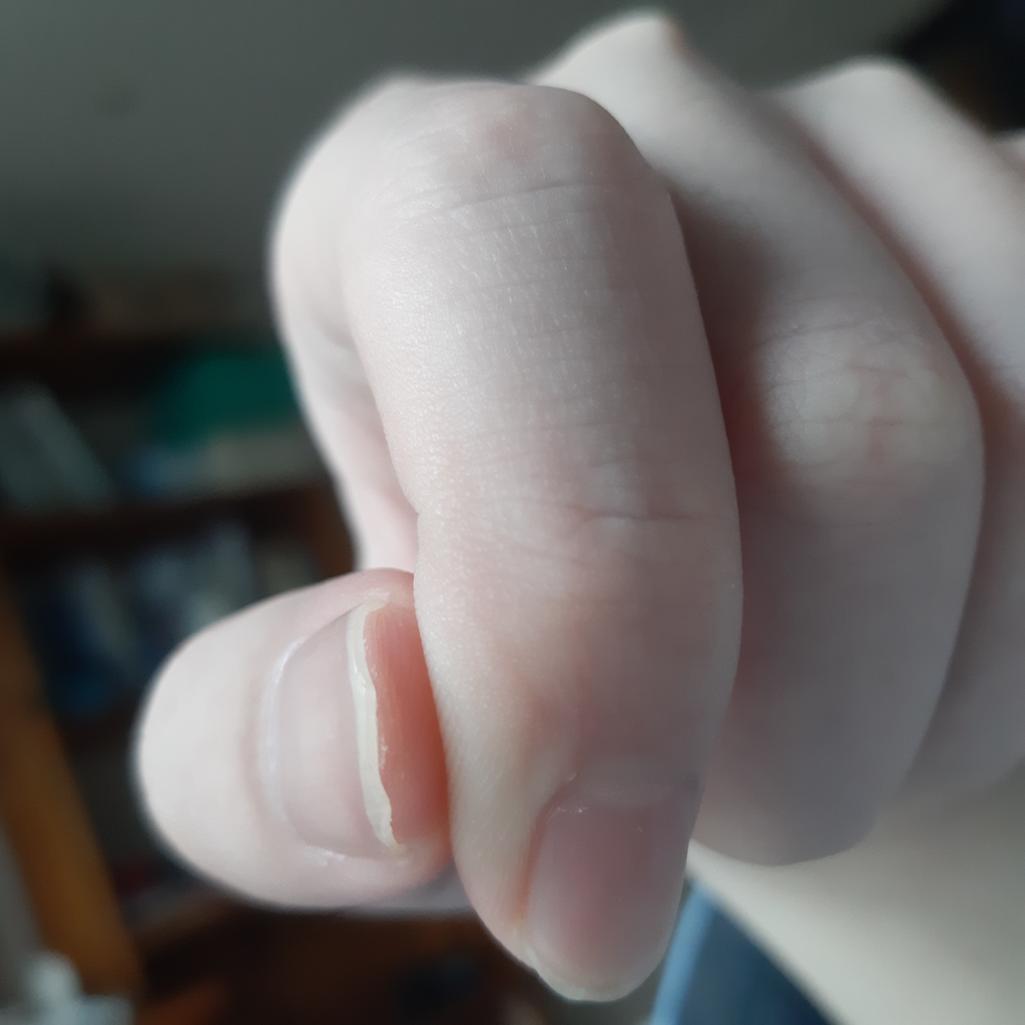 2번 째 사진