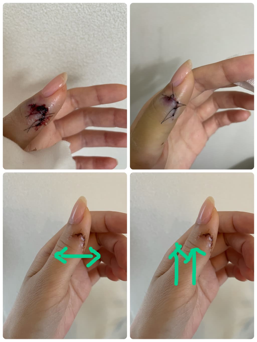 1번 째 사진