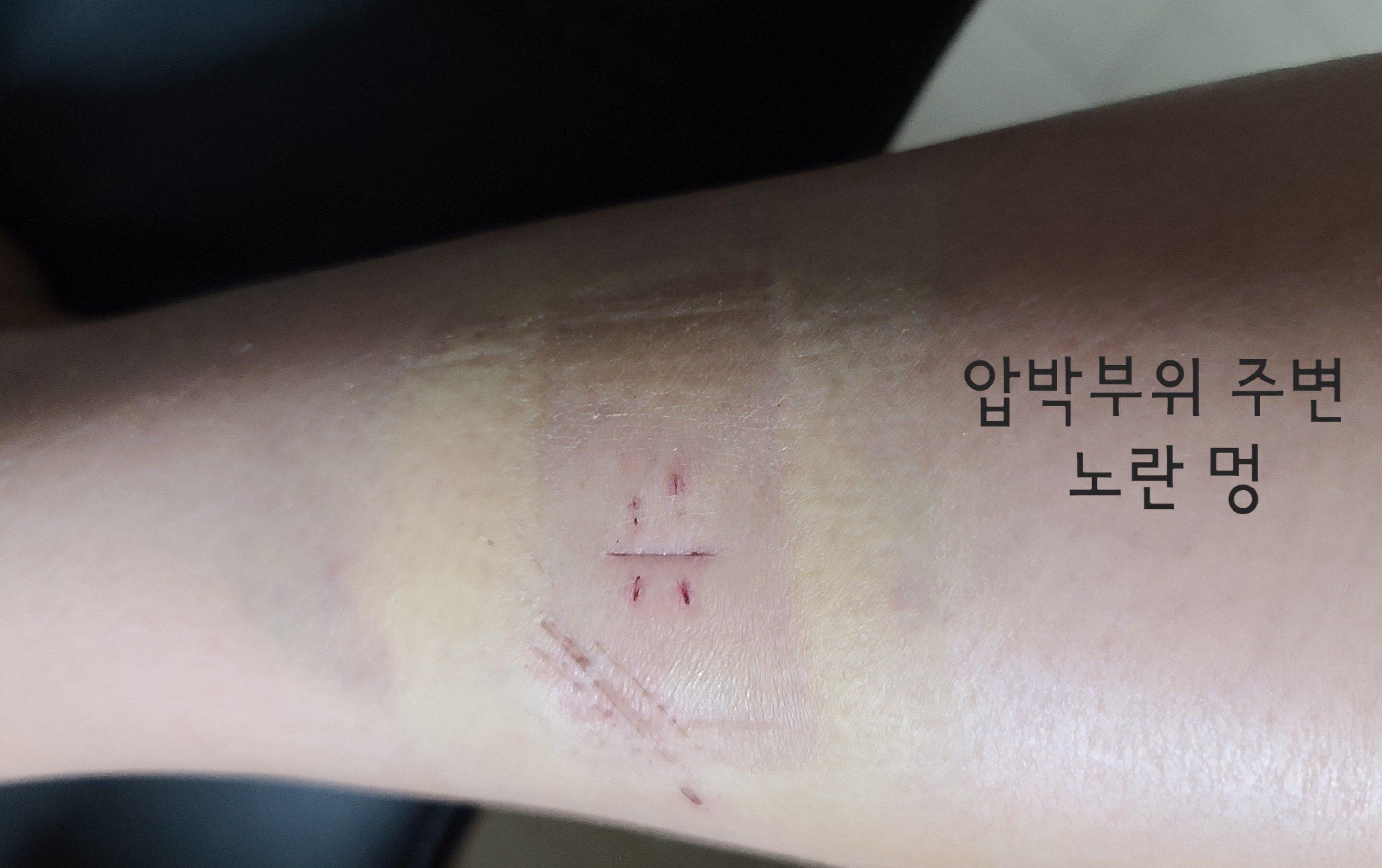 4번 째 사진