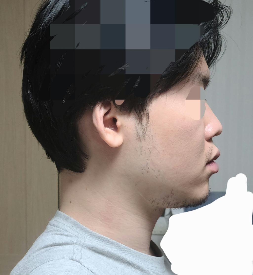 4번 째 사진