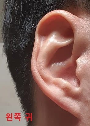 2번 째 사진