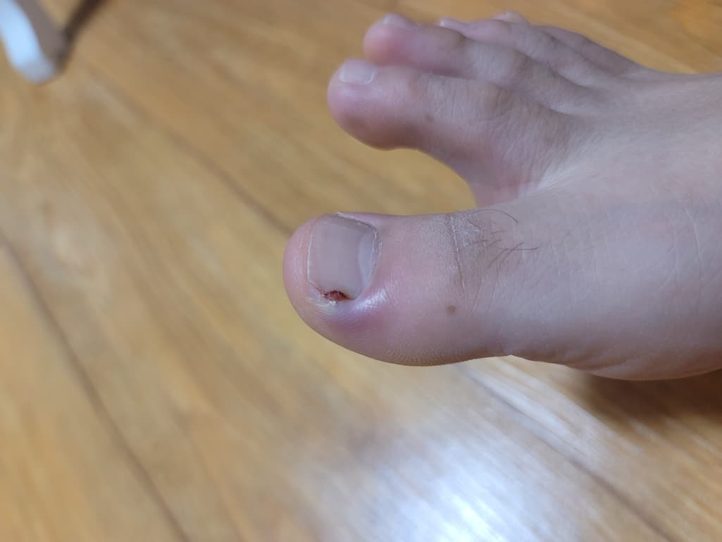 1번 째 사진