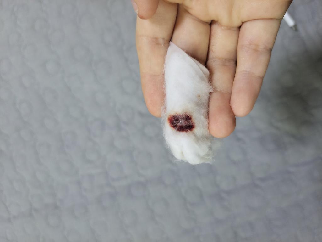 2번 째 사진
