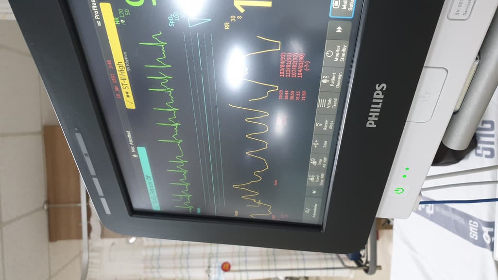 2번 째 사진