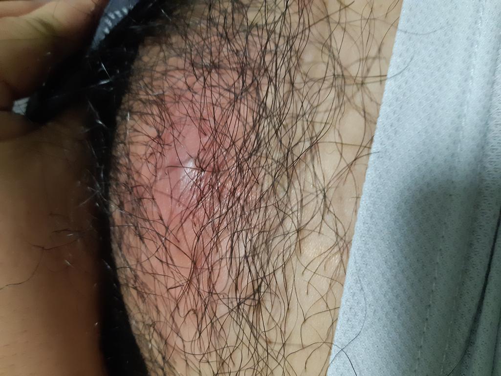 2번 째 사진