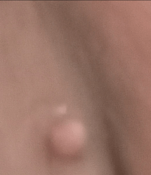 2번 째 사진