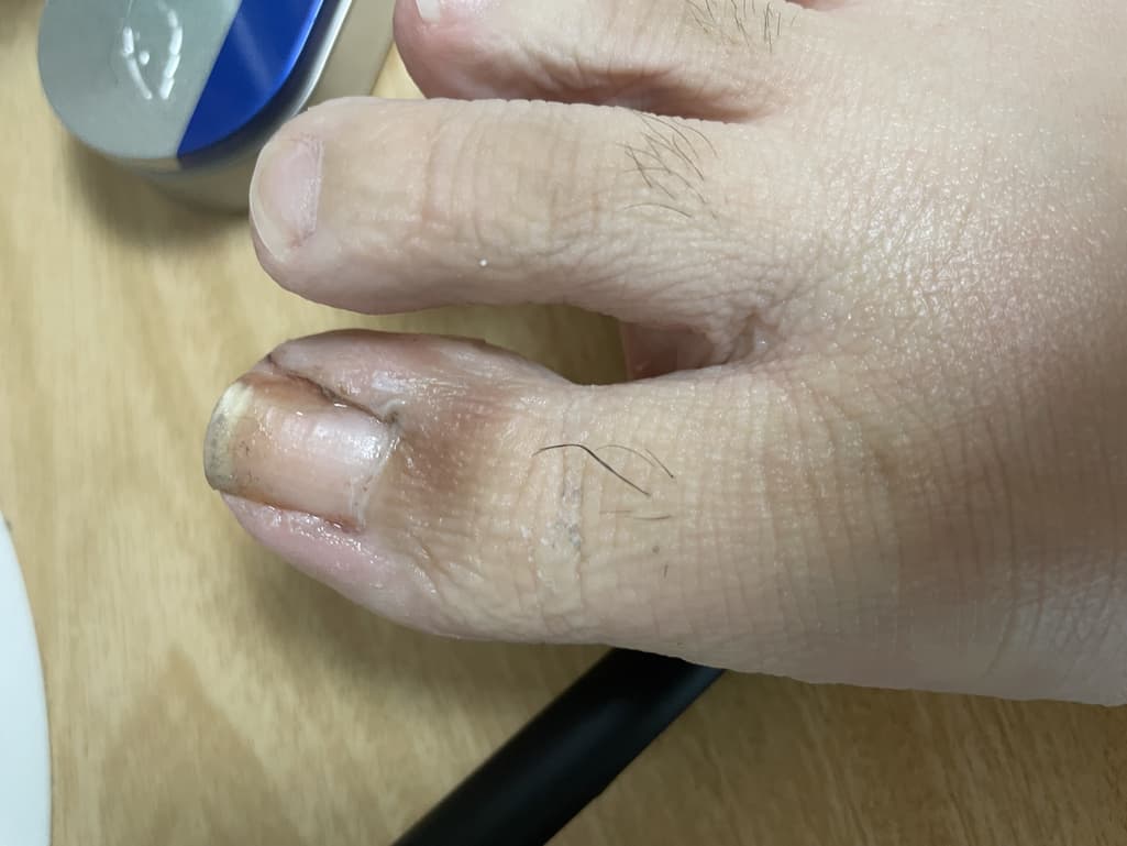 2번 째 사진