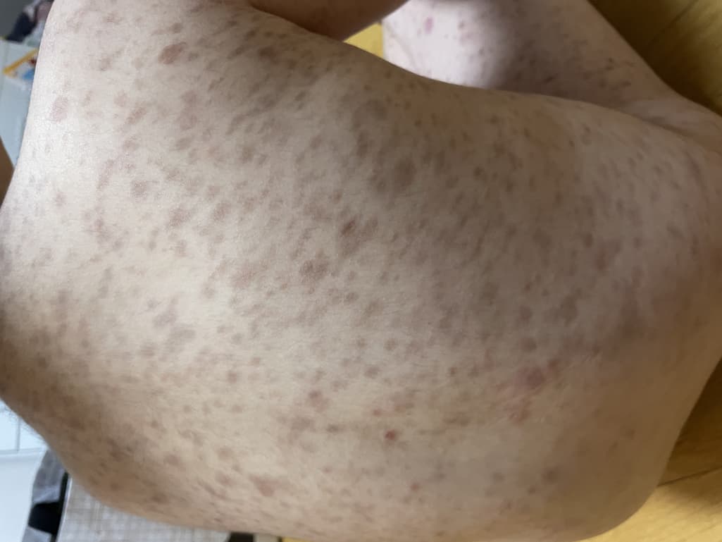 2번 째 사진