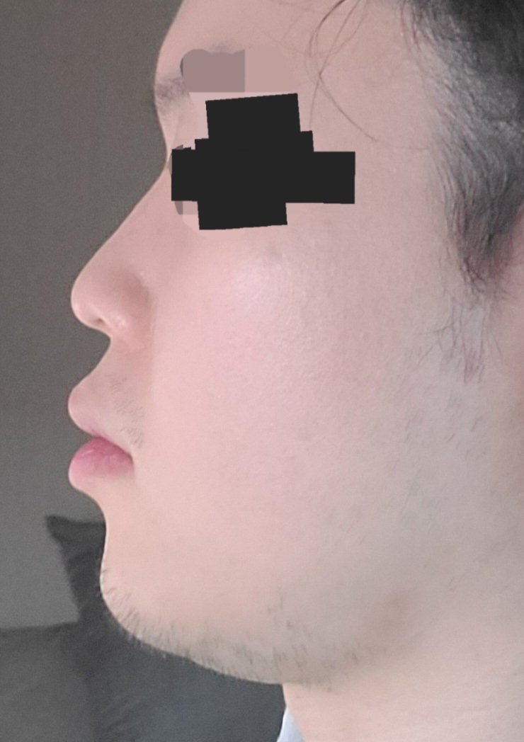 9번 째 사진