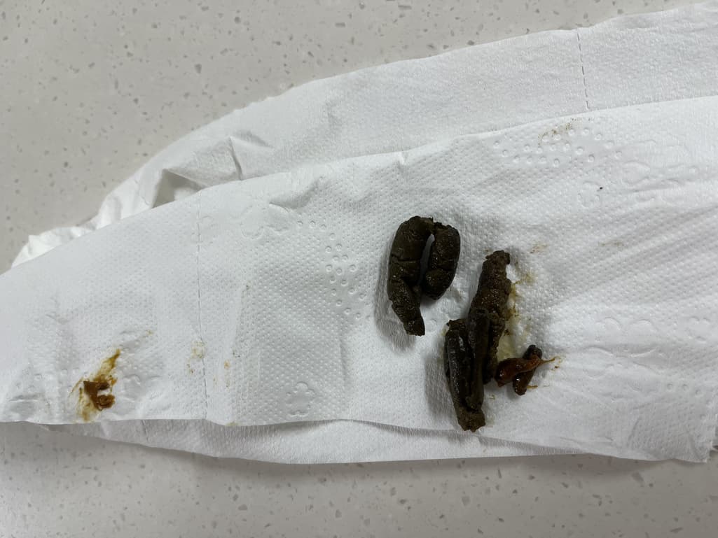2번 째 사진