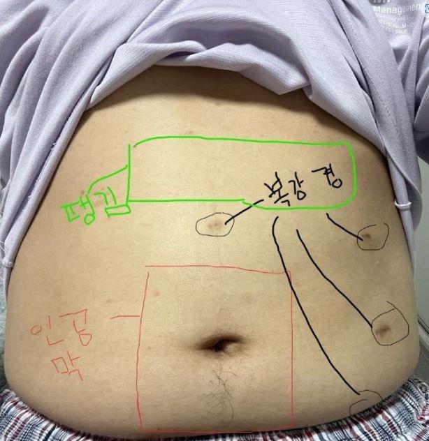 1번 째 사진