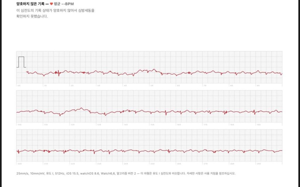 2번 째 사진