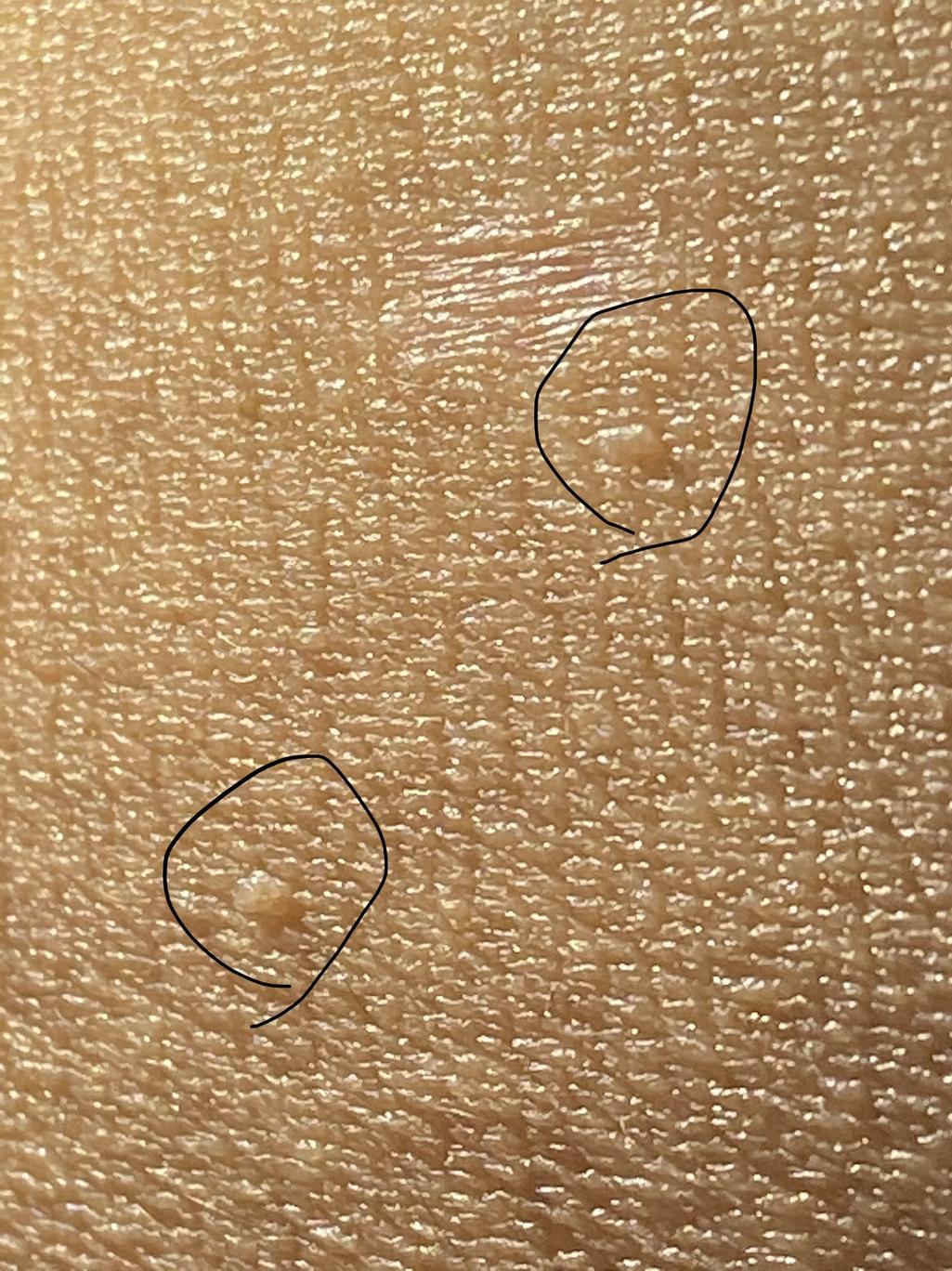 4번 째 사진