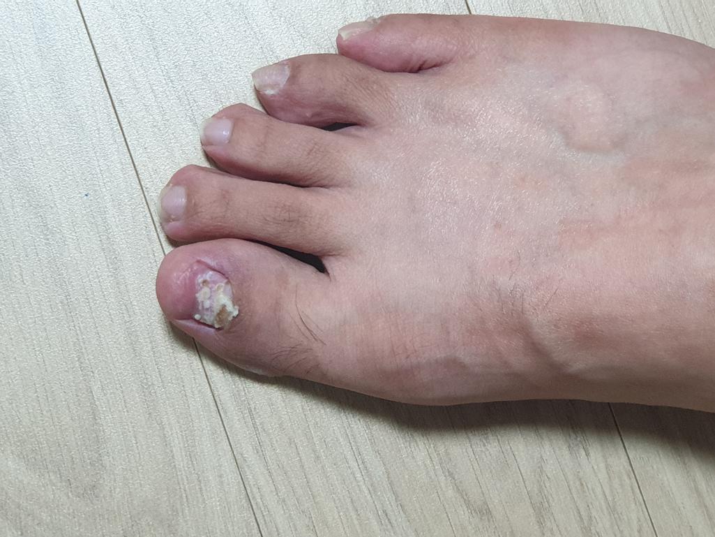 1번 째 사진