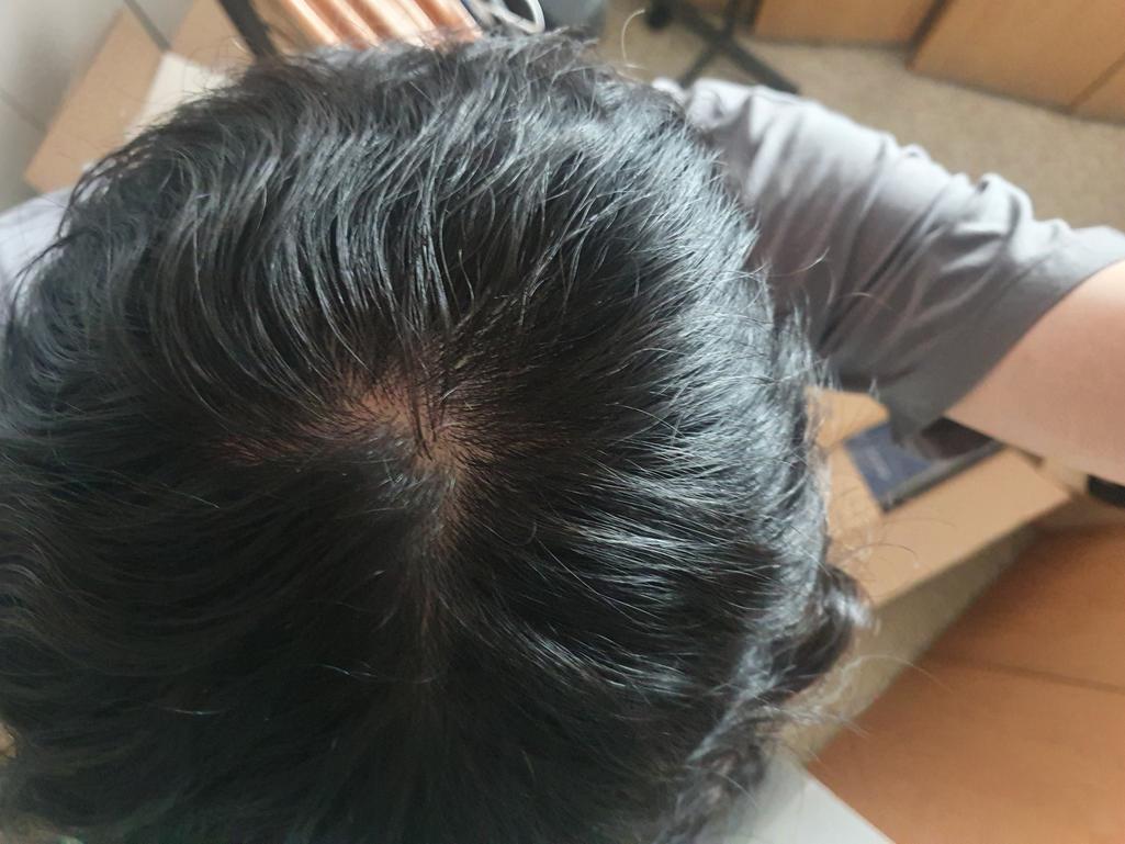 2번 째 사진