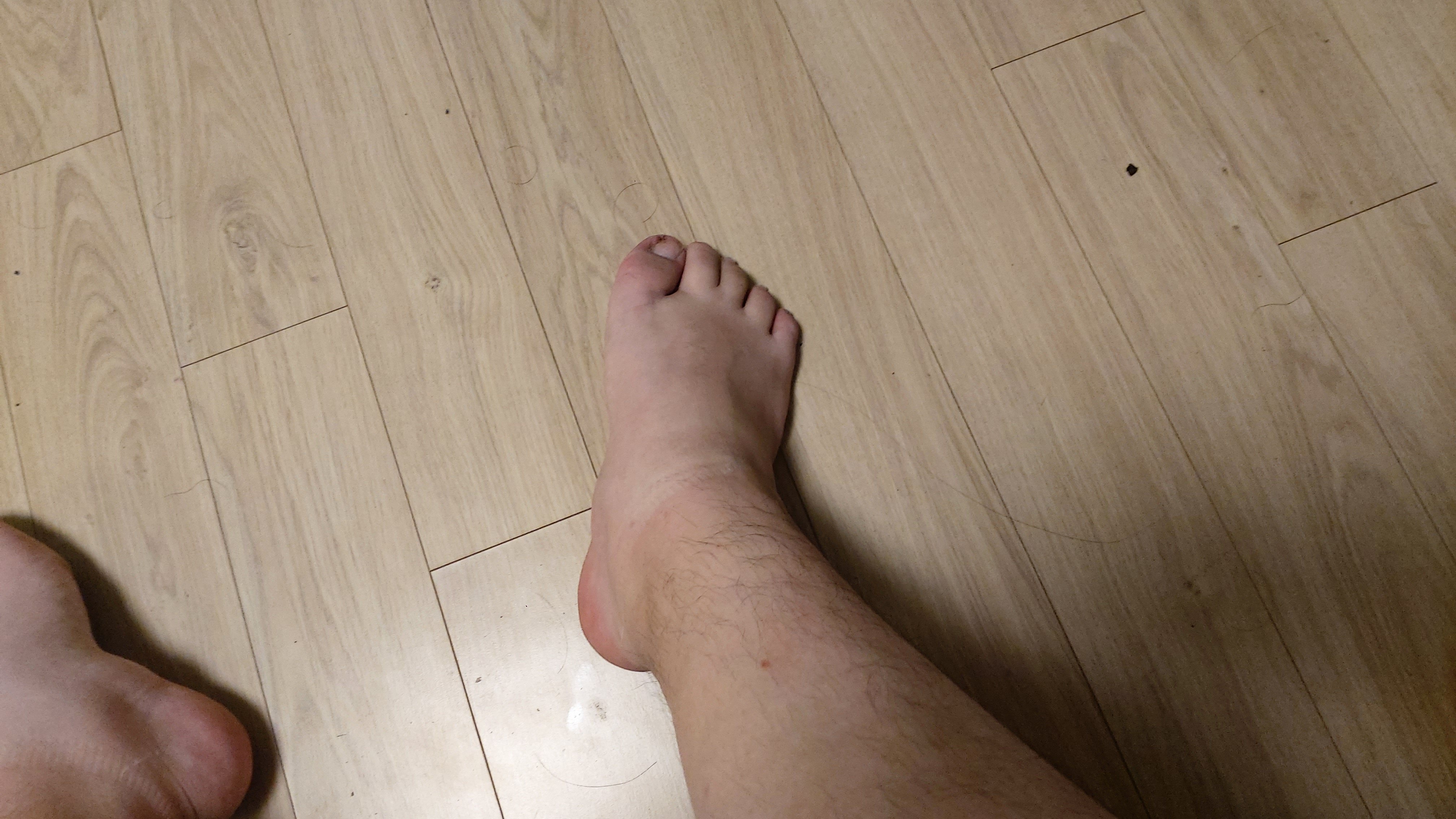 2번 째 사진