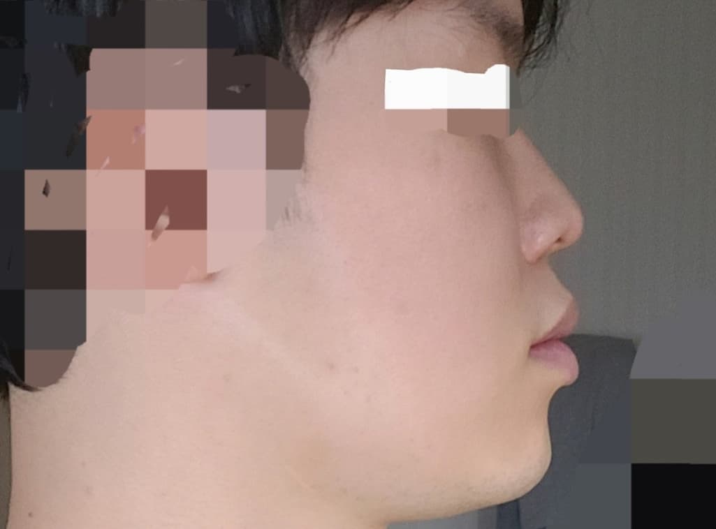 3번 째 사진