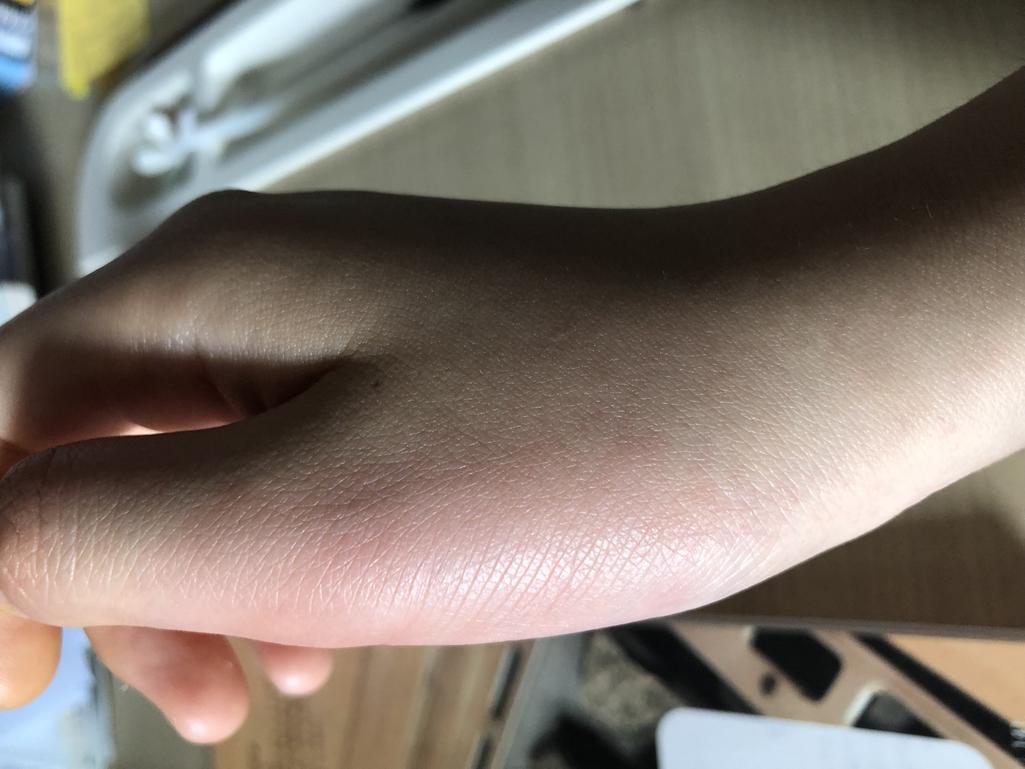 2번 째 사진