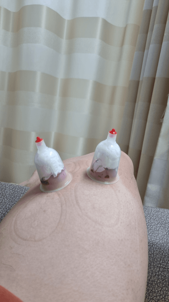 1번 째 사진