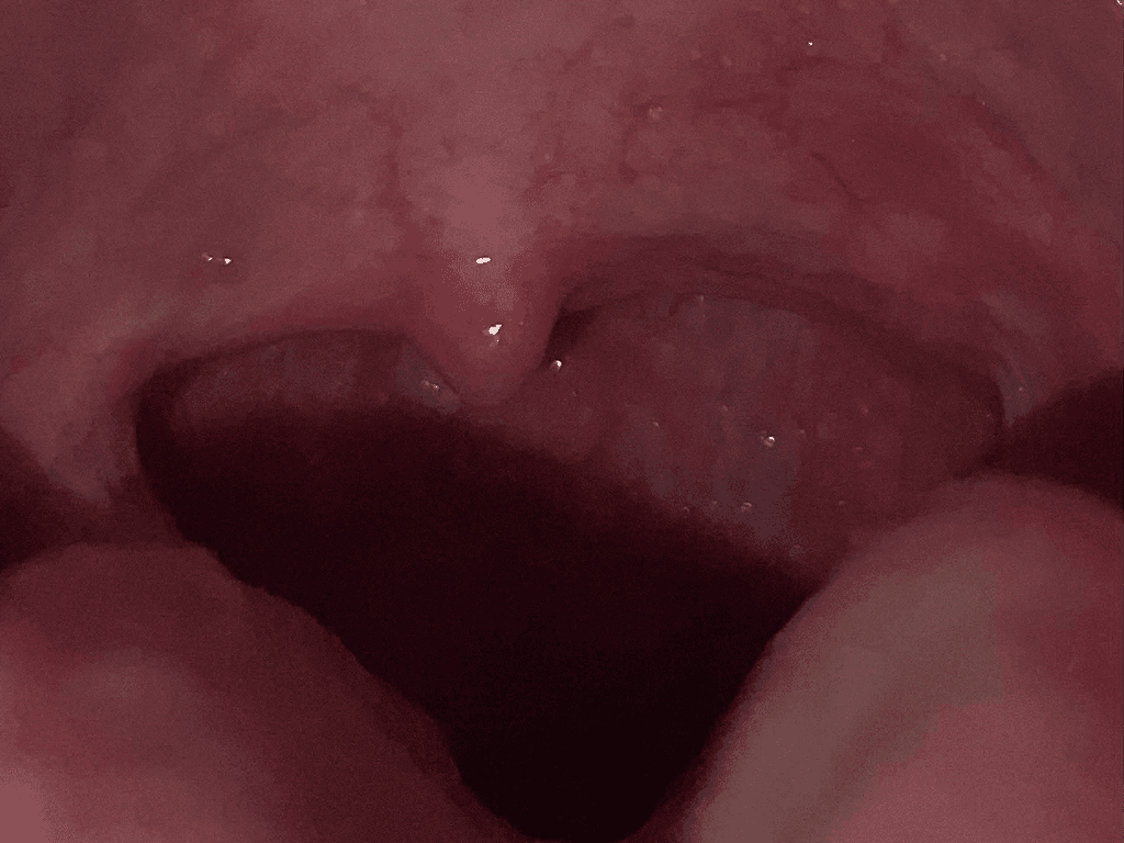 2번 째 사진