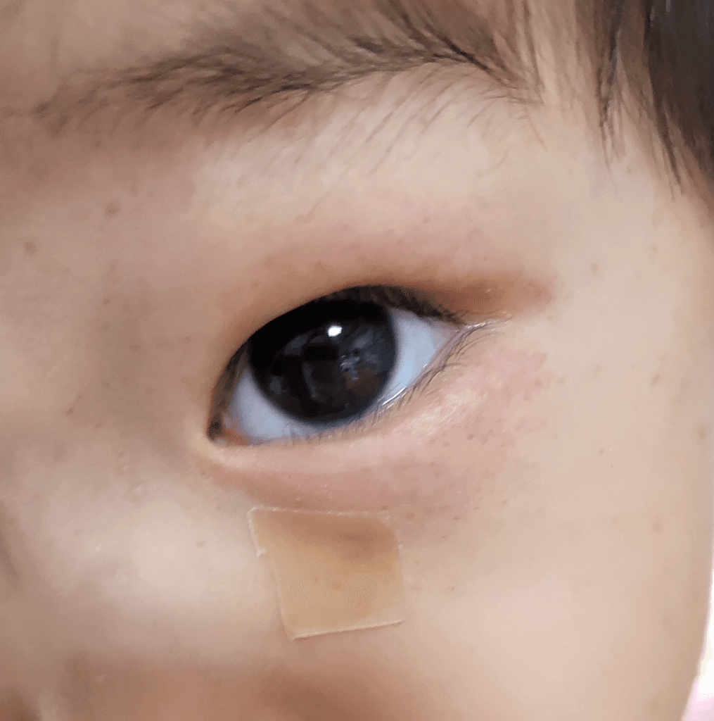 2번 째 사진