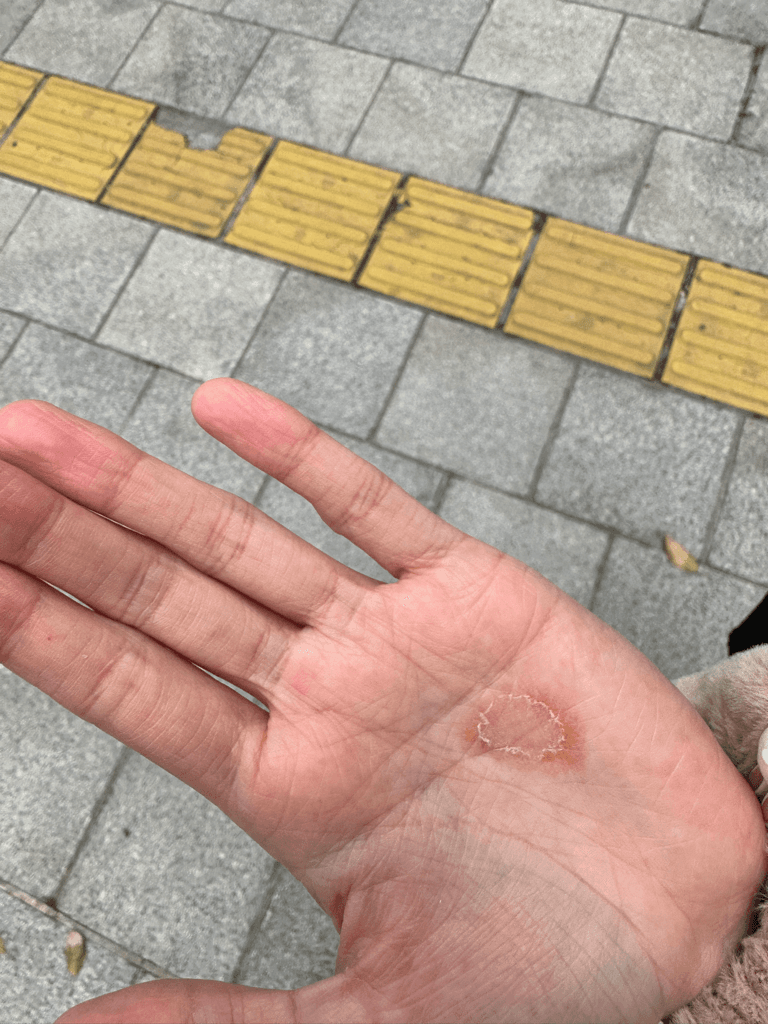1번 째 사진