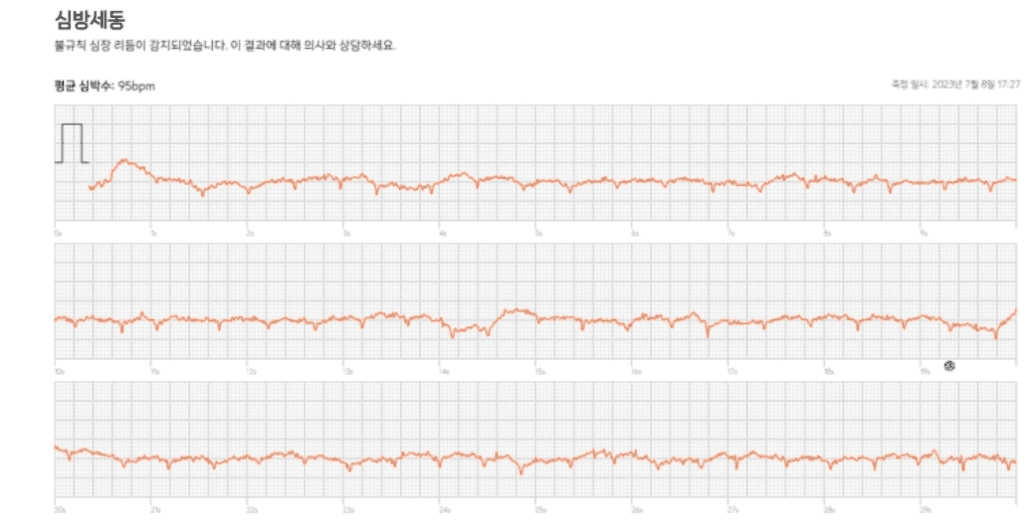 2번 째 사진