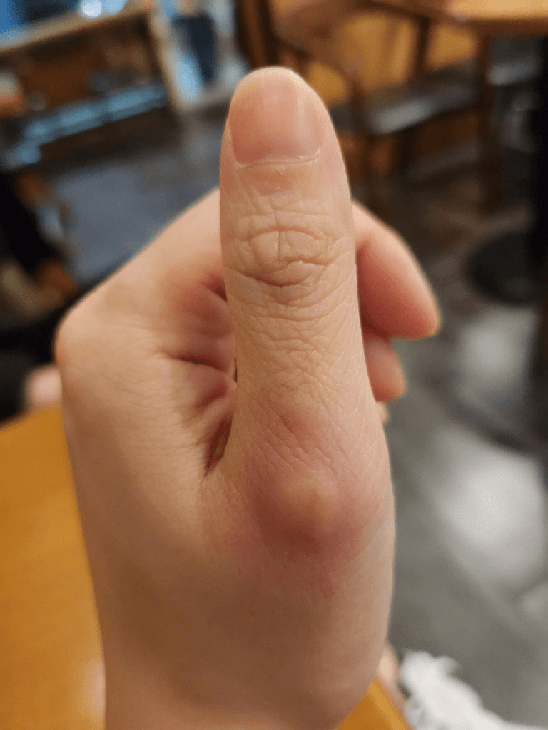 1번 째 사진