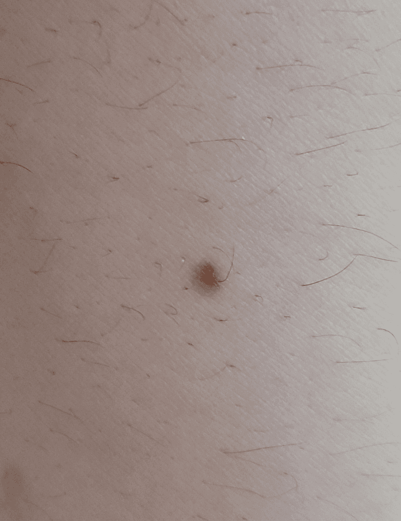 2번 째 사진
