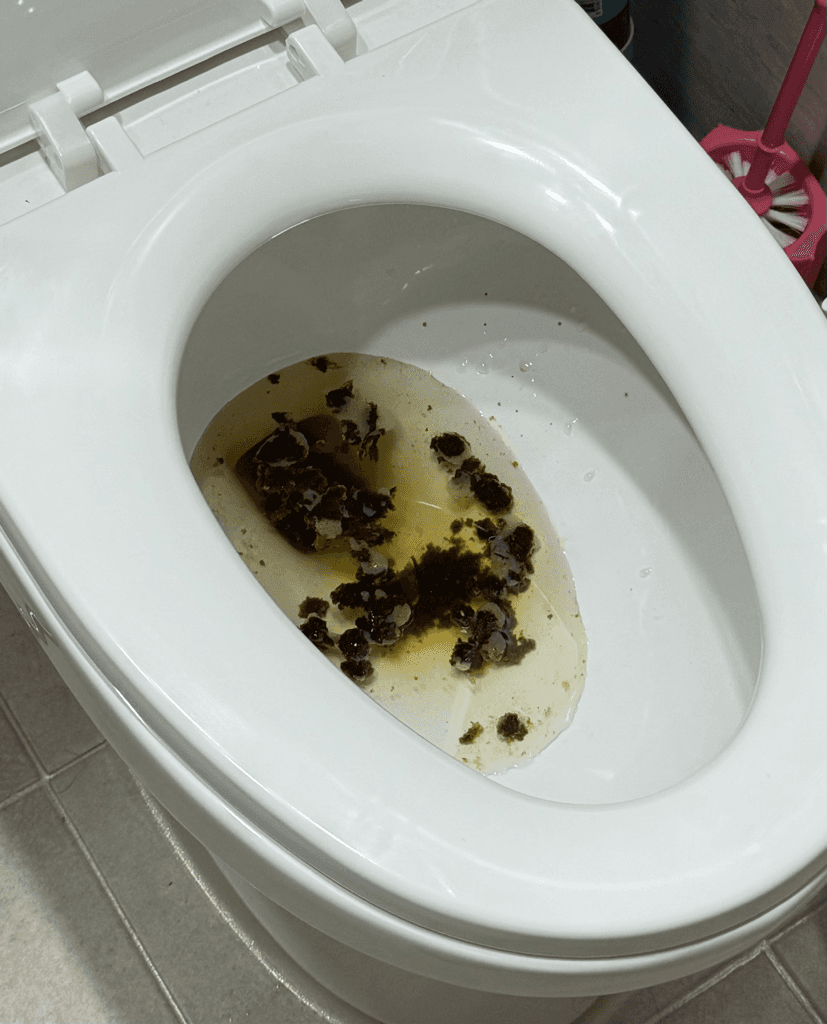 2번 째 사진