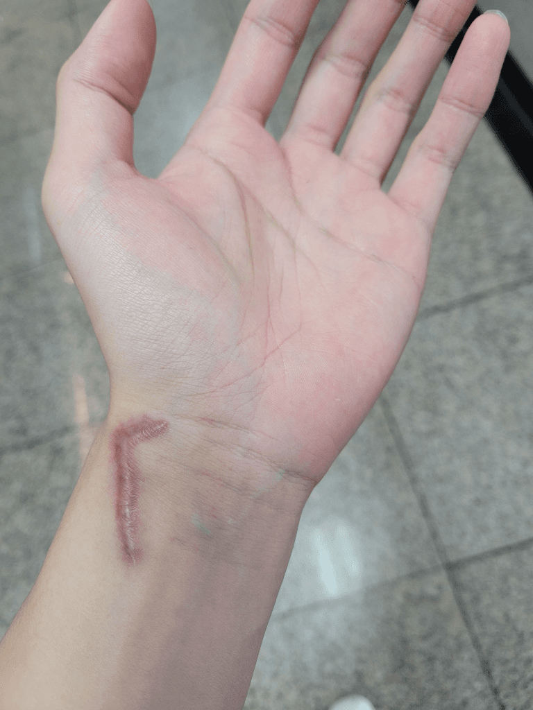1번 째 사진