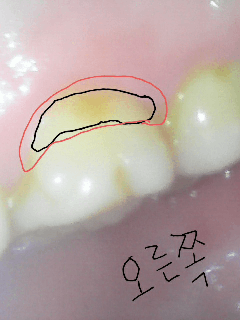 2번 째 사진