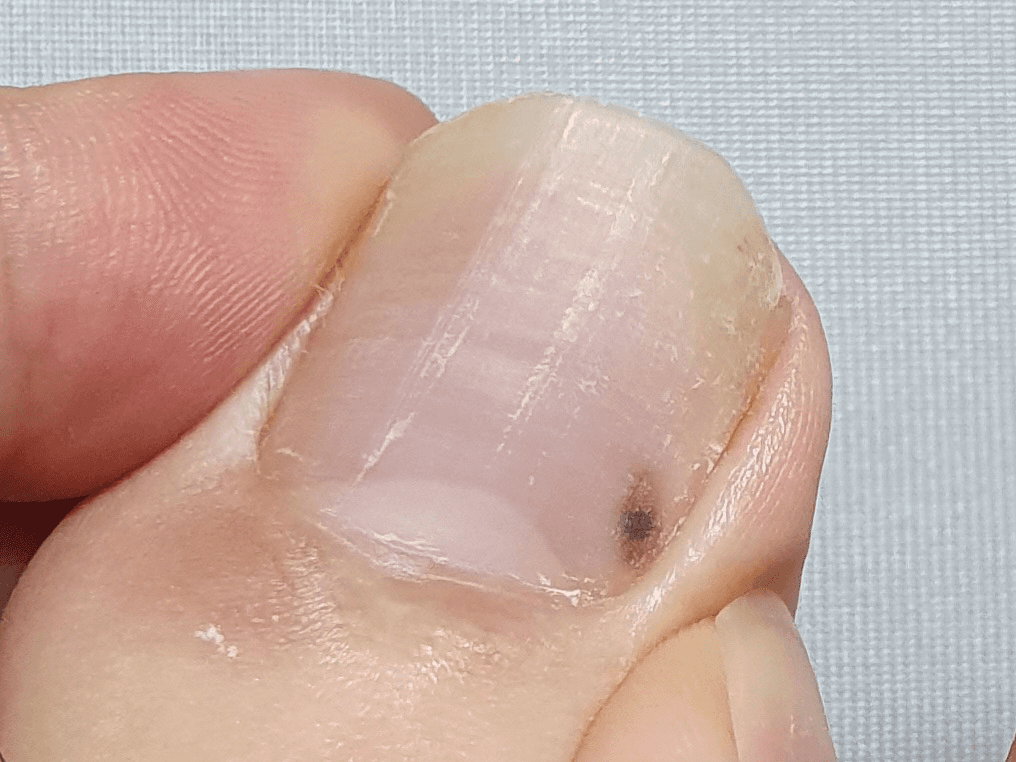 2번 째 사진