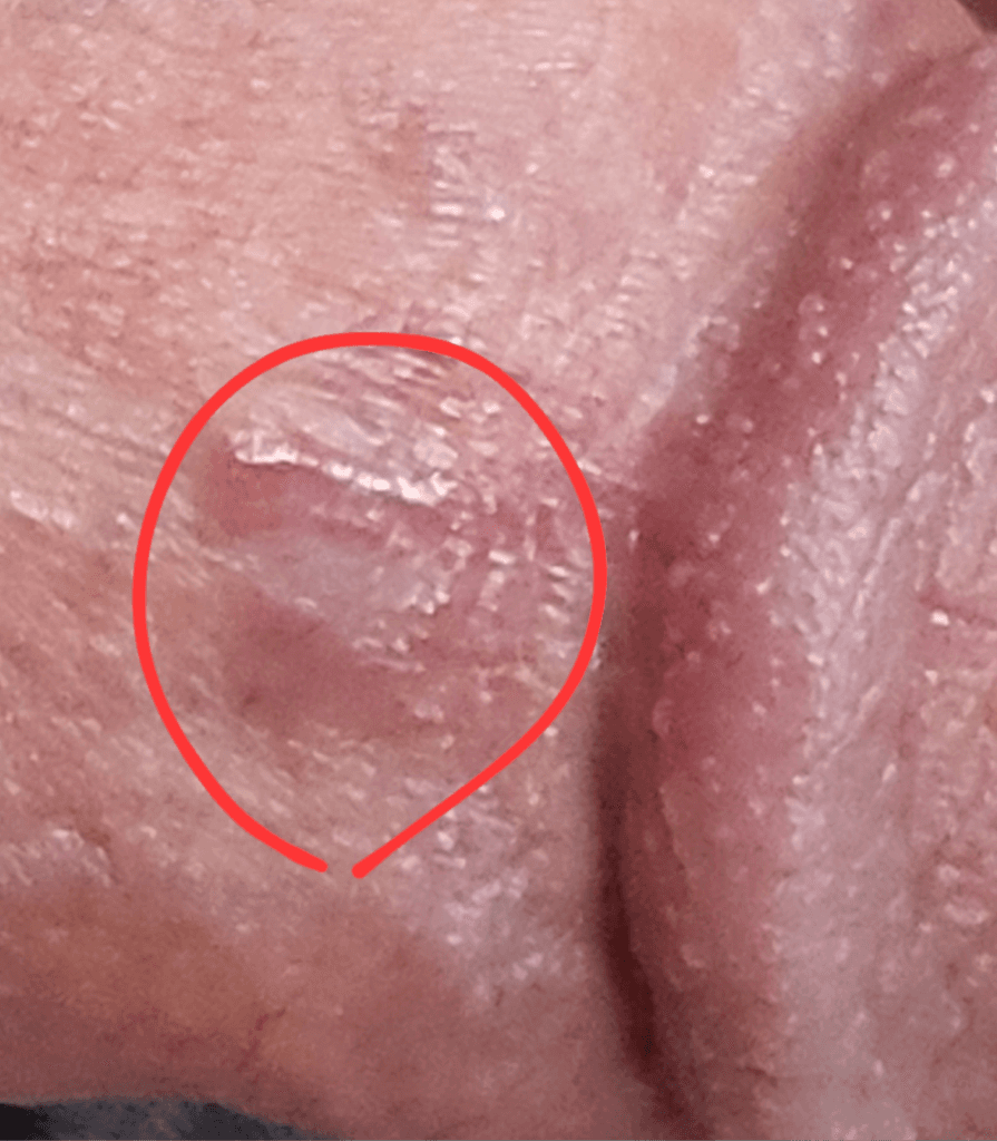 3번 째 사진