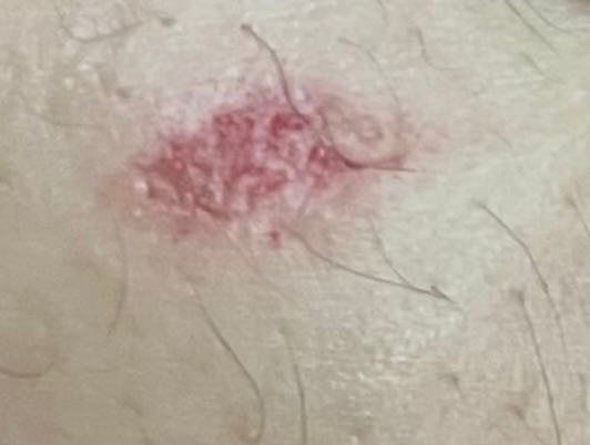 2번 째 사진
