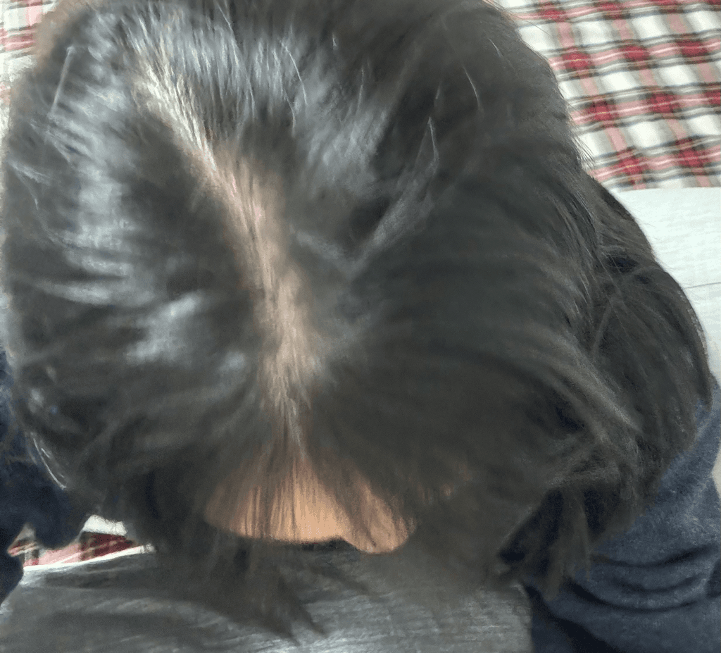 2번 째 사진