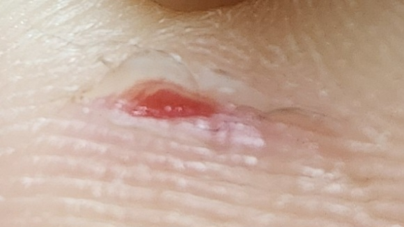 1번 째 사진