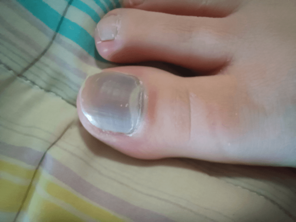 3번 째 사진