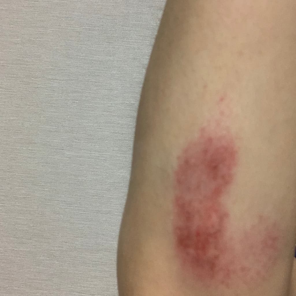2번 째 사진