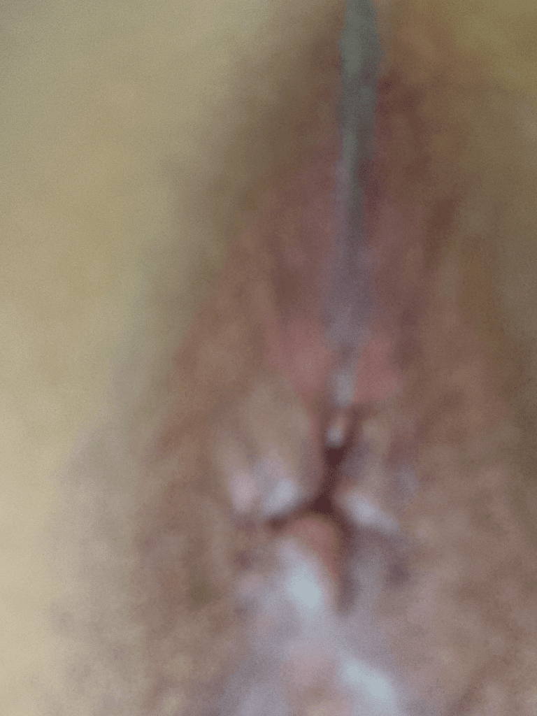 2번 째 사진