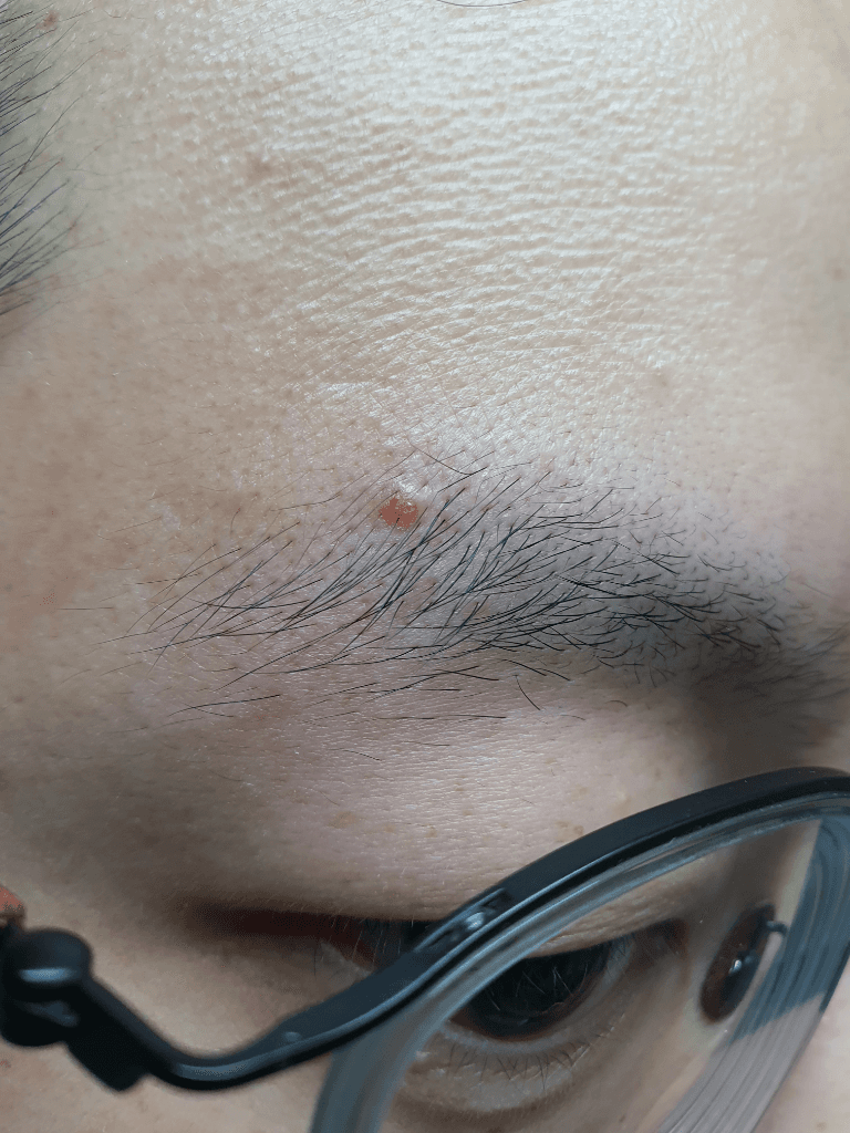 2번 째 사진