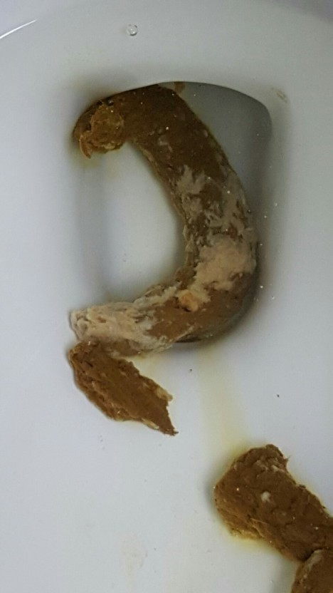 2번 째 사진